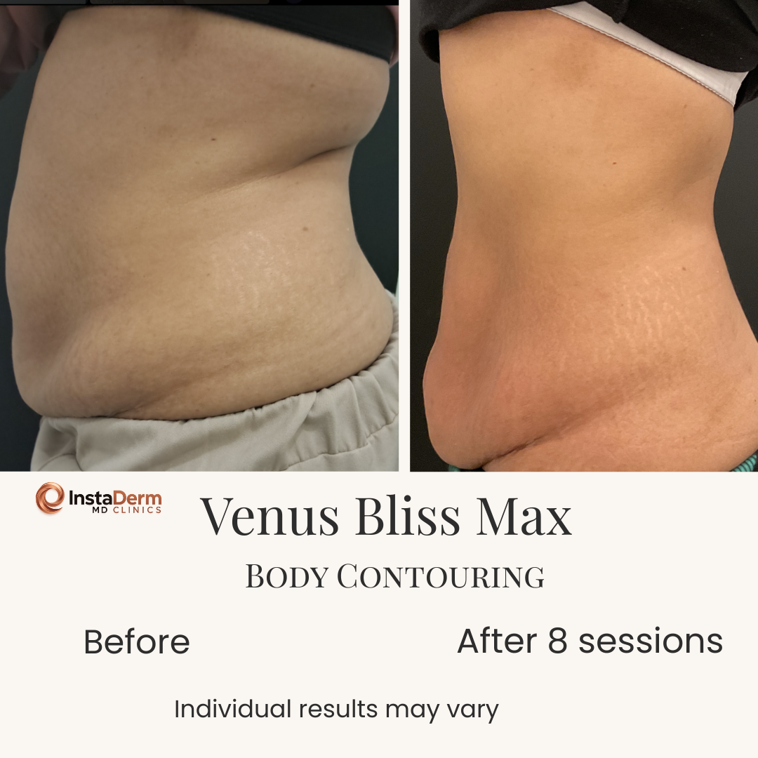 Beige Minimalist Skincare Before and After Instagram Post-4