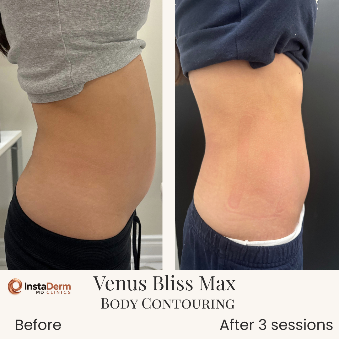 Beige Minimalist Skincare Before and After Instagram Post-6