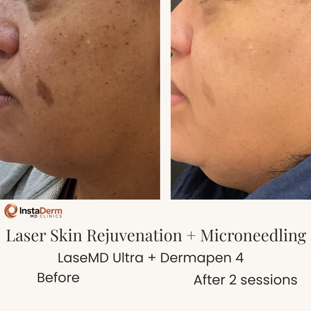 Beige Minimalist Skincare Before and After Instagram Post-8