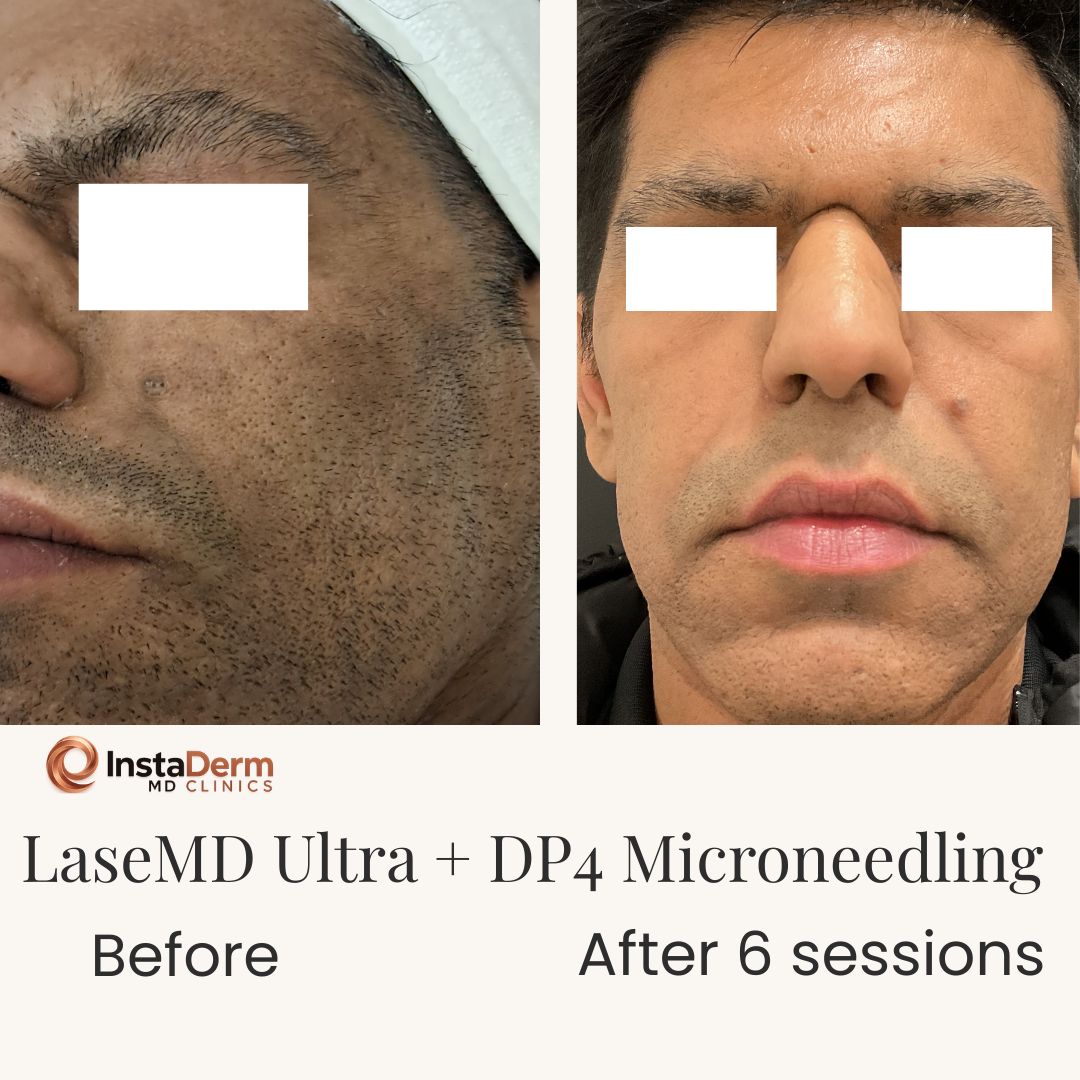 Beige Minimalist Skincare Before and After Instagram Post