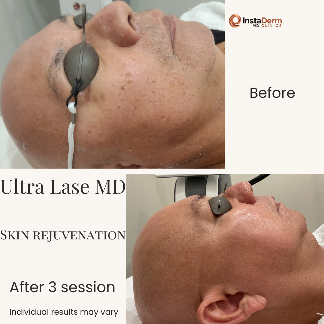 Beige Minimalist Skincare Before and After Instagram Post