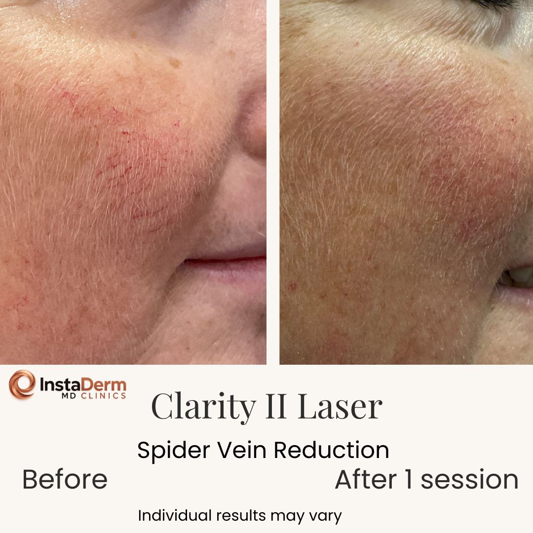 Beige Minimalist Skincare Before and After Instagram