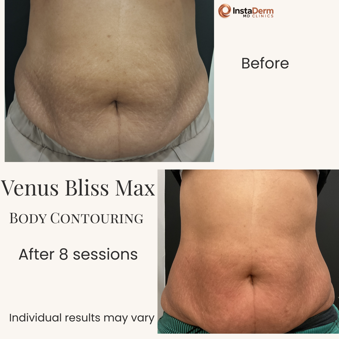 Minimalist Skincare Before and After Instagram Post-2