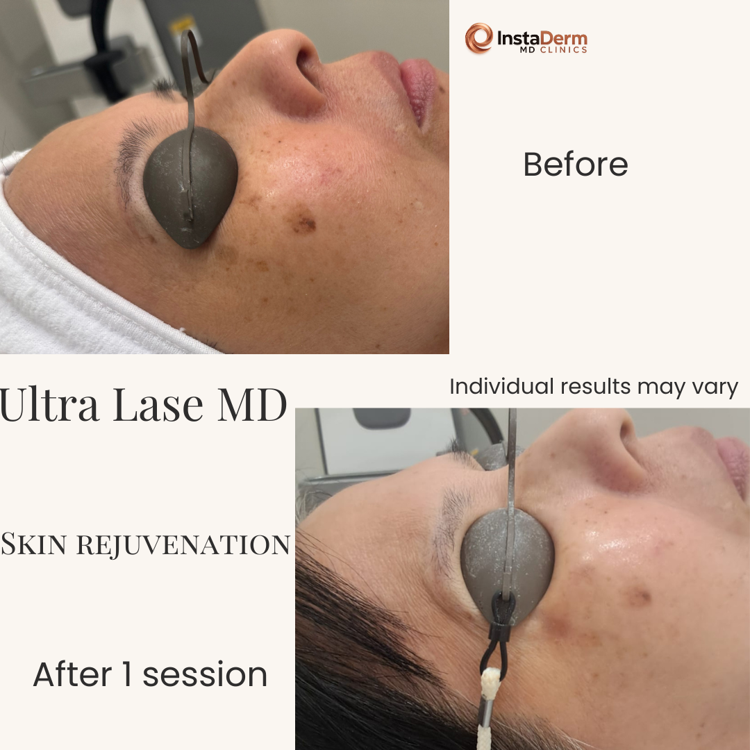 Minimalist Skincare Before and After Instagram Post-3