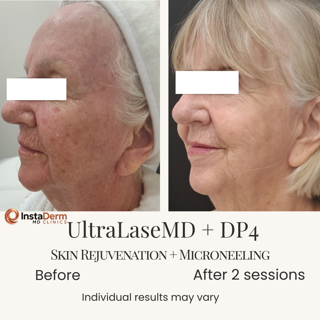 Minimalist Skincare Before and After Instagram Post-4